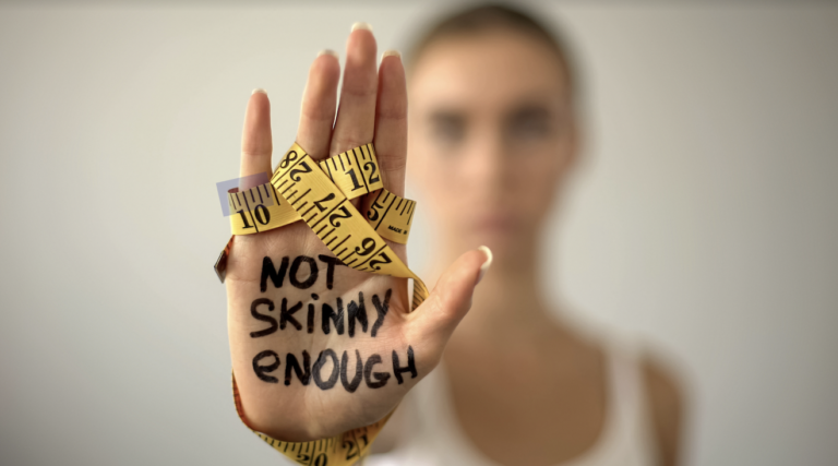 What You Need to Know About Anorexia